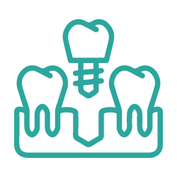 Root Canal Treatment (RCT)