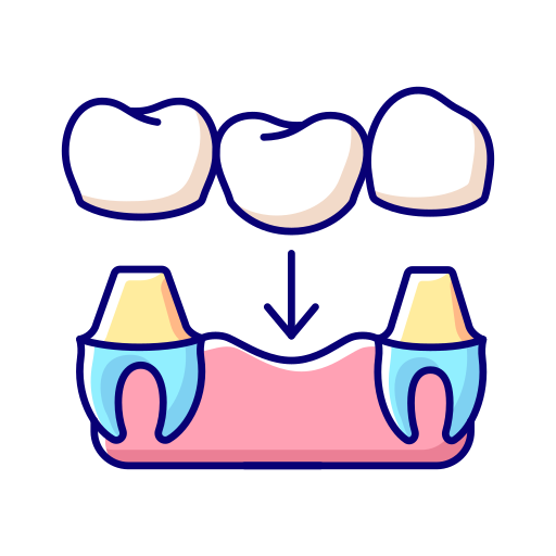 Dental Crowns & Veneers