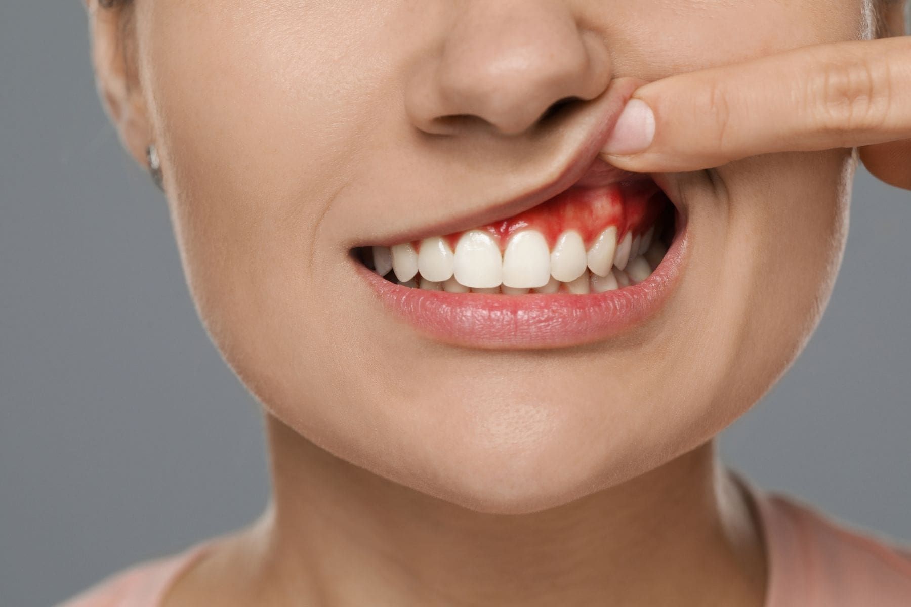 Gum Disease Treatment (Periodontics)